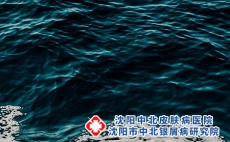 沈阳牛皮癣为什么那么难治呢