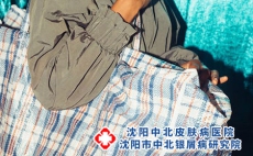 得了银屑病睡不着觉怎么办?