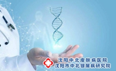 不科学疗银屑病有什么后果