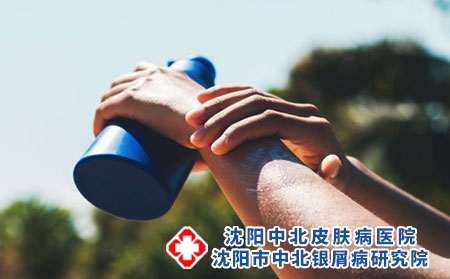牛皮癣病情反复是什么原因?如何饭后养生?