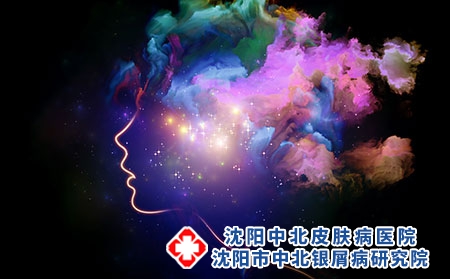 牛皮癣瘙痒怎么办?反复发作的原因有哪些?