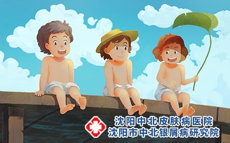 【小满至，炎夏始】沈阳中北银屑病医院银屑病夏季养生指南