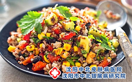 牛皮癣患者饮食禁忌有哪些?不能吃什么?