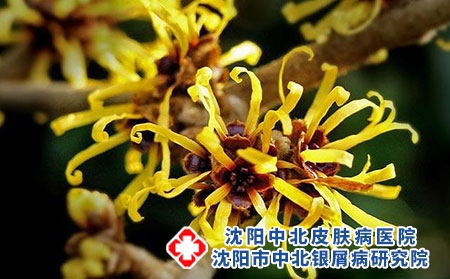 沈阳南三经街银屑病研究院：皮肤银屑病是什么症状