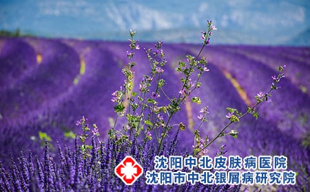 沈阳治疗牛皮癣到中北医院好：牛皮癣疾病还会出现哪些并发症?