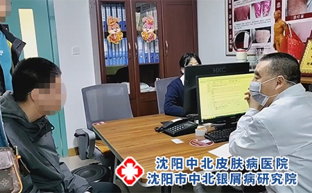沈阳哪看银屑病好-沈阳哪里能治银屑病
