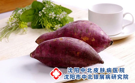 3 (109)紫薯红薯饮食