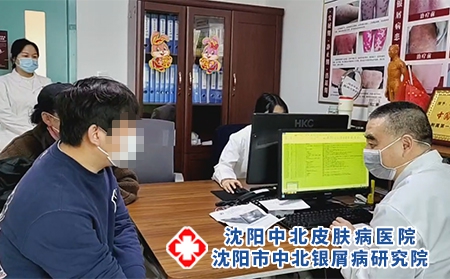 沈阳好的银屑病看-沈阳市中北银屑病研究院-沈阳哪治银屑病最好