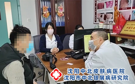 沈阳哪个银屑病好-沈阳市中北银屑病研究院-沈阳哪里医治银屑病
