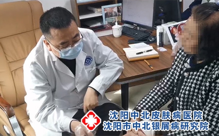沈阳看银屑病好的-沈阳市中北银屑病研究院-沈阳哪有专治银屑病 沈阳看银屑病好的-沈阳市中北银屑病研究院-沈阳哪有专治银屑病