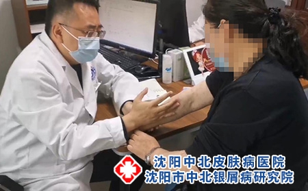 沈阳看银屑病费用-沈阳市中北银屑病研究院-沈阳哪治疗银屑病好 沈阳看银屑病费用-沈阳市中北银屑病研究院-沈阳哪治疗银屑病好