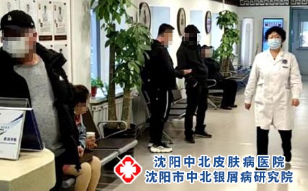 沈阳银屑病怎么样-沈阳中北银屑病医院-沈阳牛皮癣医院费用