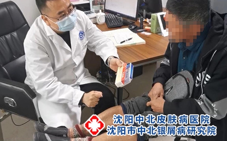 辽宁牛皮癣康复中心 - 沈阳中北医院 辽宁牛皮癣康复中心 - 沈阳中北医院