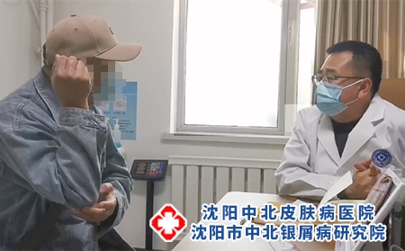 中北医院牛皮癣坐诊专家 - 沈阳中北医院 中北医院牛皮癣坐诊专家 - 沈阳中北医院