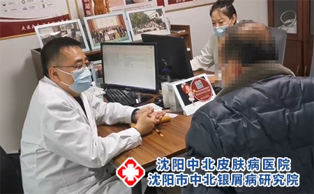 中北医院银屑病公益普查 - 沈阳中北医院 中北医院银屑病公益普查 - 沈阳中北医院