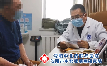 沈阳中北医院治牛皮癣好吗 - 沈阳中北医院 沈阳中北医院治牛皮癣好吗 - 沈阳中北医院