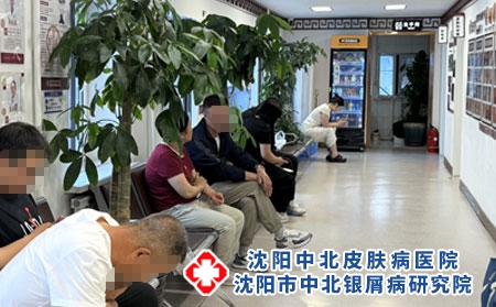 沈阳中医治银屑病场景 - 沈阳中北医院