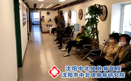 沈阳银屑病专家门诊 - 沈阳中北医院 沈阳银屑病专家门诊 - 沈阳中北医院