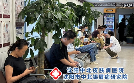 辽宁牛皮癣专科口碑诊疗机构-沈阳中北医院 辽宁牛皮癣专科口碑诊疗机构-沈阳中北医院