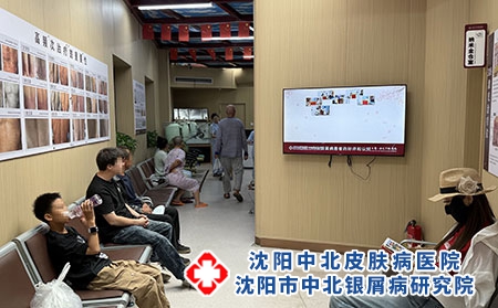 辽宁牛皮癣分型诊疗专业医院-沈阳中北医院 辽宁牛皮癣分型诊疗专业医院-沈阳中北医院
