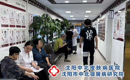 辽宁牛皮癣专科权威就诊机构-沈阳中北医院 辽宁牛皮癣专科权威就诊机构-沈阳中北医院