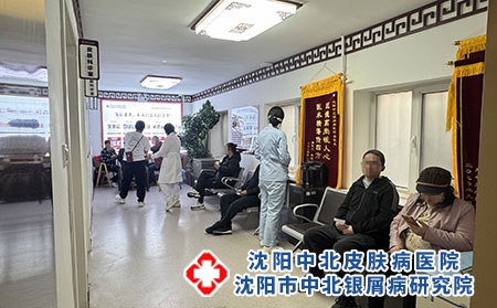 辽宁牛皮癣患者优选诊疗医院-沈阳中北医院