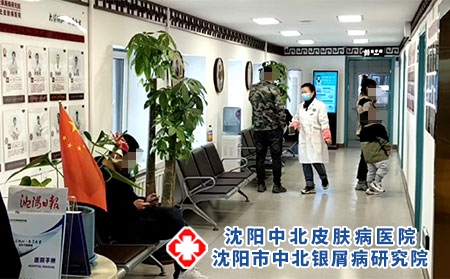 东北银屑病专科医院---沈阳中北医院 东北银屑病专科医院---沈阳中北医院
