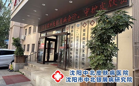 辽宁牛皮癣诊疗靠谱医院排名---沈阳中北医院 辽宁牛皮癣诊疗靠谱医院排名---沈阳中北医院