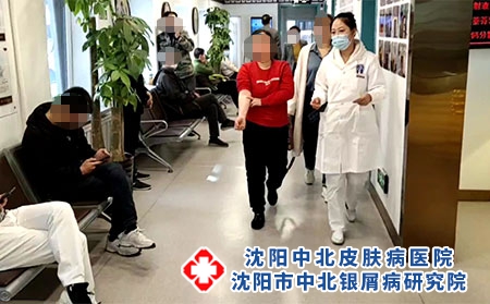 辽宁牛皮癣专科康复诊疗中心-沈阳中北医院