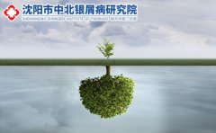 牛皮肤癣中药治疗方法：牛皮肤癣有什么中药能治疗