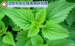 怎样才能做好牛皮肤癣的预防