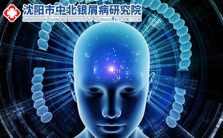 红皮型银屑病是如何引起的_辽宁沈阳银屑病医院