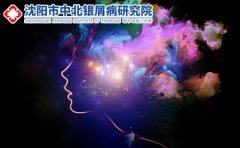 银屑病反复发作的主要原因?辽宁沈阳银屑病专科医院告诉你