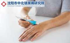 如何防治银屑病反复发作?辽宁沈阳看银屑病医院告诉你