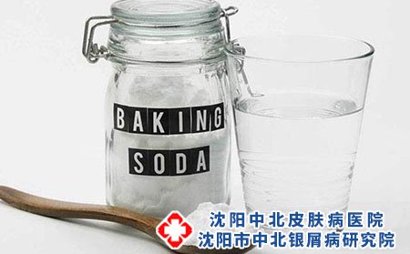 沈阳中北银屑病医院看银屑病专业