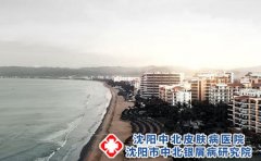 沈阳看银屑病中北医院好