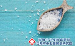 沈阳中北银屑病研究院正规不