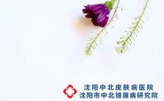 沈阳中北银屑病研究院正规不吗