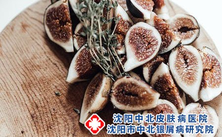 牛皮癣患者不宜吃什么?有什么排毒食物?