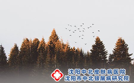 牛皮癣久治不愈的原因有哪些？如何预防？