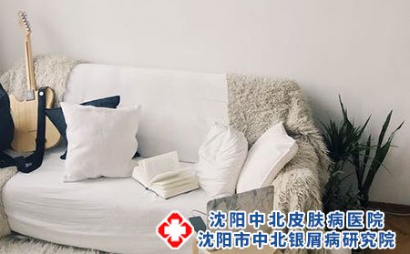 女性牛皮癣病因有哪些?可以喝啤酒吗?