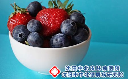 女性牛皮癣患者经期保健应该怎么做?