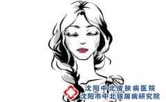 好的治疗女性牛皮癣方法有什么?