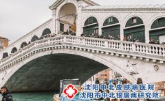 牛皮癣的治疗原则是什么
