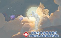 牛皮癣的治疗方案都有哪些啊?