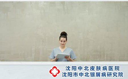 什么人容易患上牛皮癣病因分析?