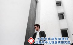 牛皮癣的症状表现有哪些?治疗药物有哪些?