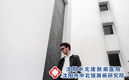 牛皮癣的症状表现有哪些?治疗药物有哪些?