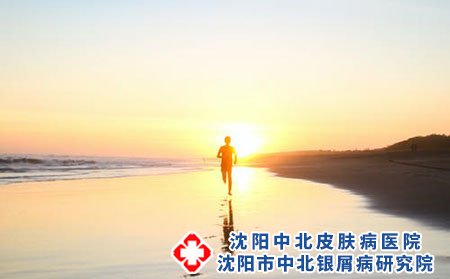 牛皮癣的症状表现有哪些?治疗药物有哪些?