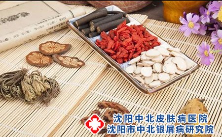 牛皮癣吃什么排毒比较好?日常护理方法?